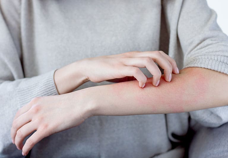 アレルギー科について