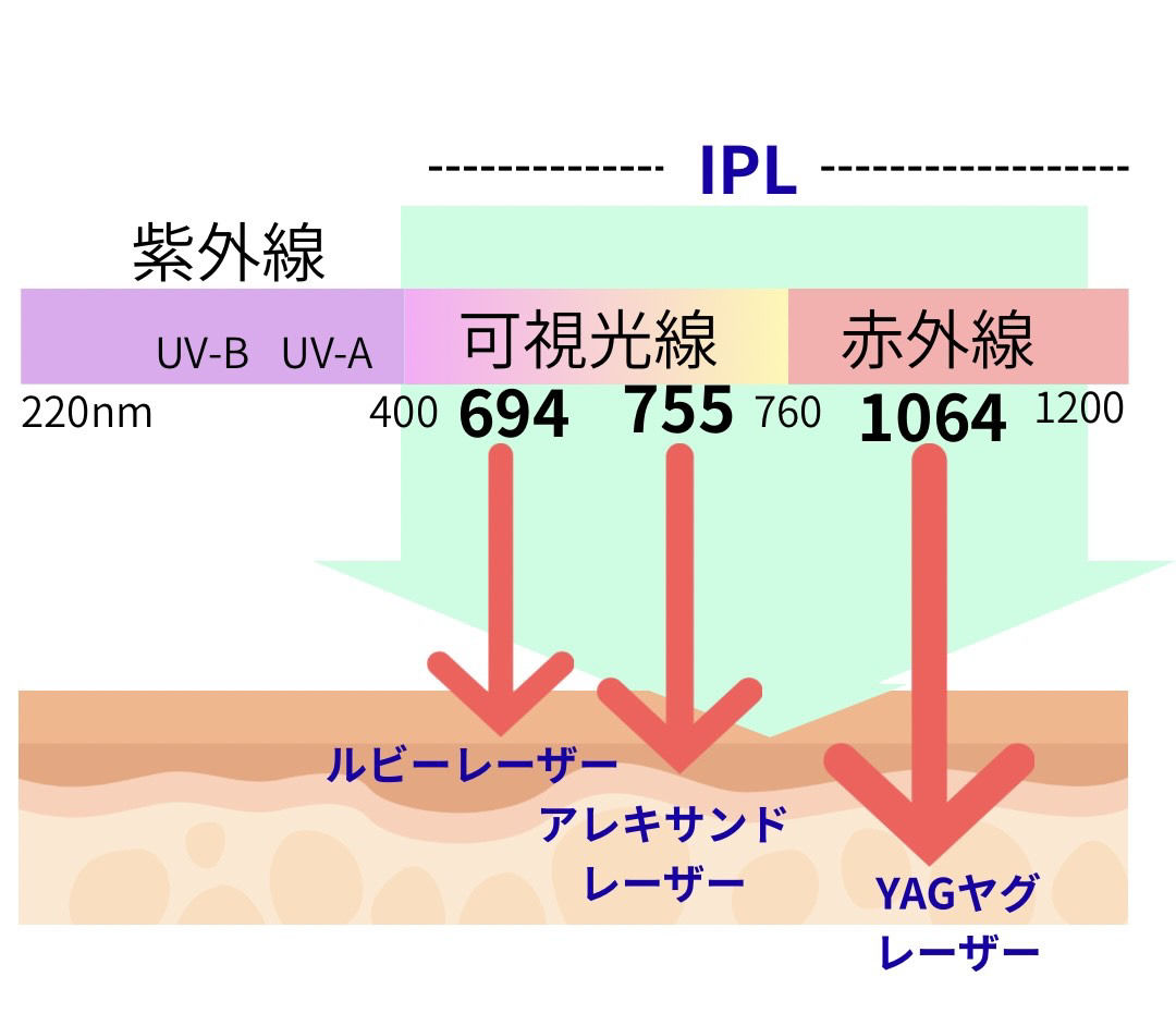 フォトフェイシャルとレーザーフェイシャル（スプレンダーフェイシャル）の違い