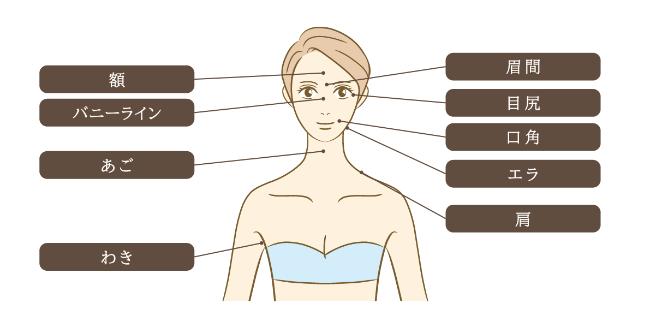 ボトックス注射の対応部位