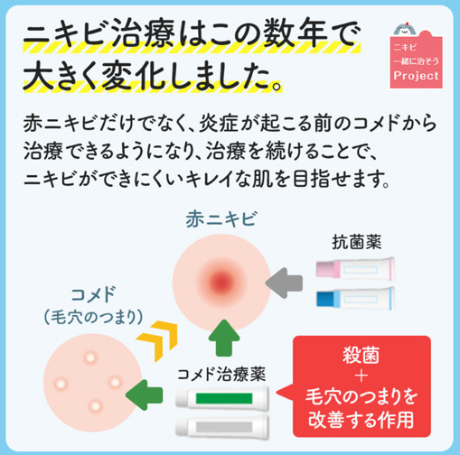 にきびの治療方法