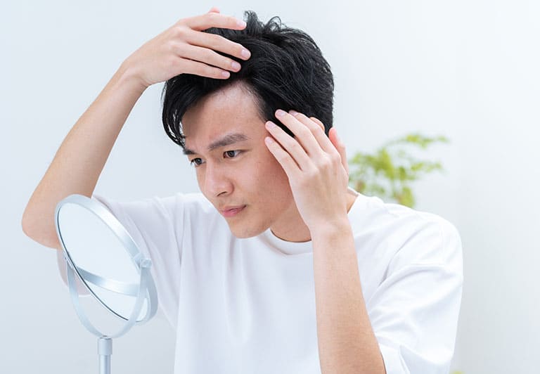 男性の薄毛・抜け毛(AGA)