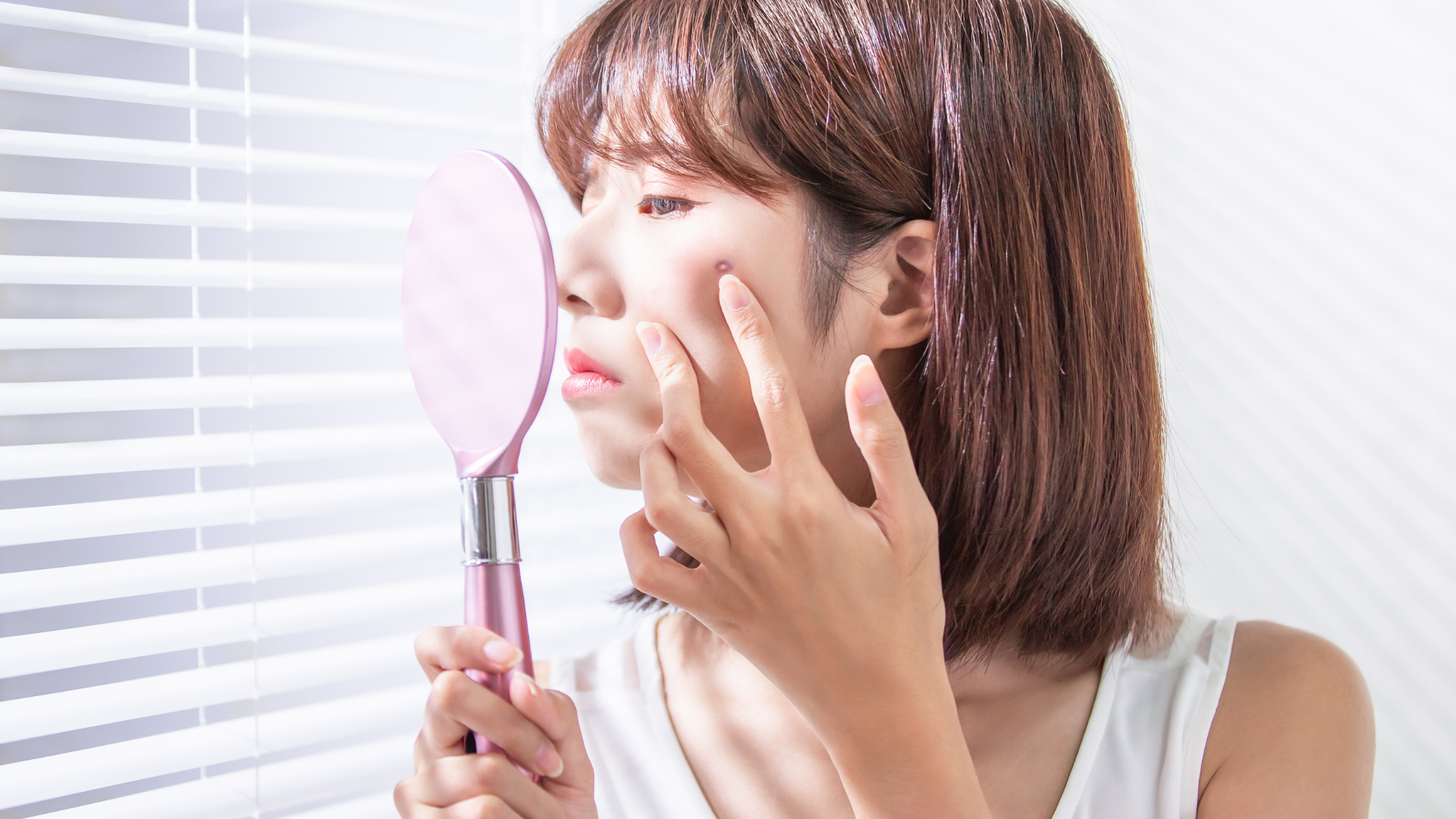 ニキビができやすい人とできにくい人の違いとは？